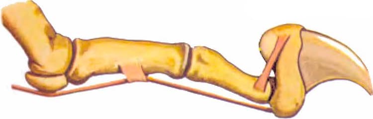 Las garras Las garras