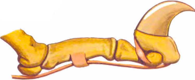 Las garras Las garras